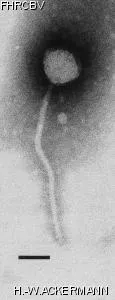 Image of phage under microscope