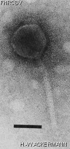 Image of phage under microscope
