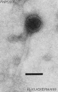 Image of phage under microscope