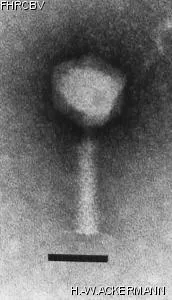 HER345 Image of phage under microscope