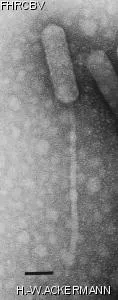 Image of phage under microscope