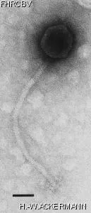 Image of phage under microscope