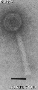 HER352 Image of phage under microscope