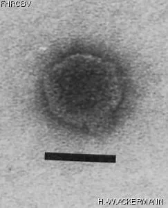 Image of phage under microscope