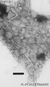 Image of phage under microscope