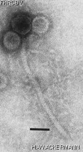 Image of phage under microscope