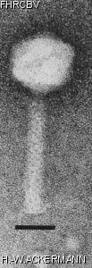 HER359 Image of phage under microscope