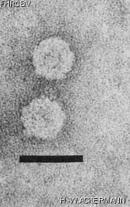 HER36 Image of phage under microscope
