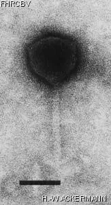 Image of phage under microscope