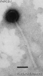 Image of phage under microscope
