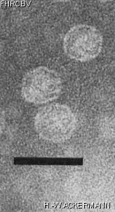 HER369 Image of phage under microscope