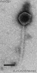 HER37 Image of phage under microscope