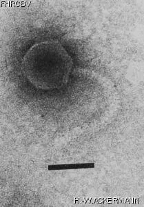 Image of phage under microscope