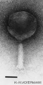 HER371 Image of phage under microscope