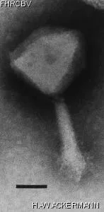Image of phage under microscope