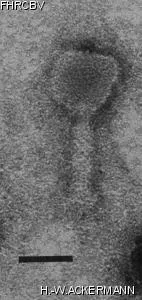 Image of phage under microscope