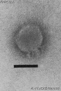 Image of phage under microscope