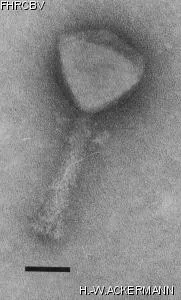 HER376 Image of phage under microscope