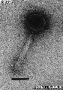 HER379 Image of phage under microscope