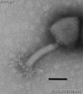 HER38 Image of phage under microscope