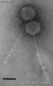HER380 Image of phage under microscope