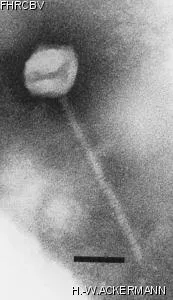 HER382 Image of phage under microscope