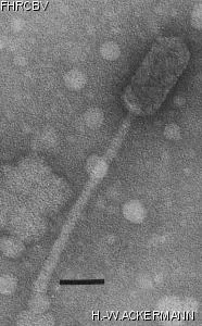 HER383 Image of phage under microscope