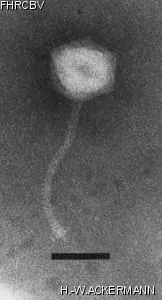 HER386 Image of phage under microscope