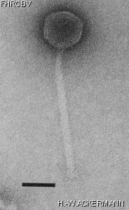 HER387 Image of phage under microscope