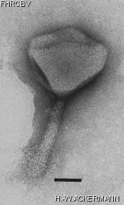 HER389 Image of phage under microscope