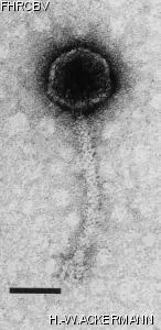 HER39 Image of phage under microscope