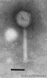HER396 Image of phage under microscope