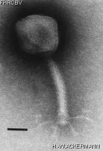 HER398 Image of phage under microscope