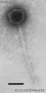 Image of phage under microscope