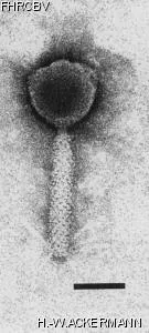 HER4 Image of phage under microscope