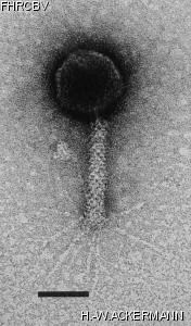 HER40 Image of phage under microscope