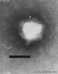 Image of phage under microscope