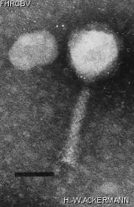 Image of phage under microscope