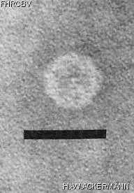 Image of phage under microscope