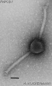 HER405 Image of phage under microscope