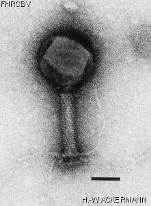 HER41 Image of phage under microscope