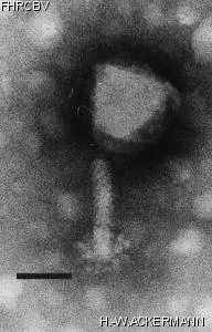 HER412 Image of phage under microscope