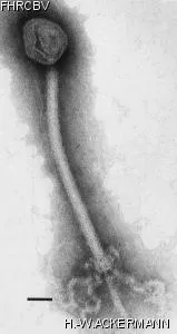 HER414 Image of phage under microscope