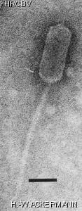 Image of phage under microscope