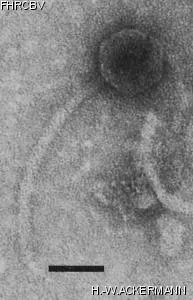 Image of phage under microscope