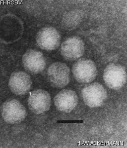 HER419 Image of phage under microscope