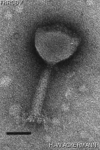 HER421 Image of phage under microscope