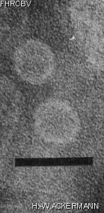 Image of phage under microscope
