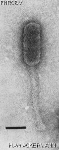 HER44 Image of phage under microscope