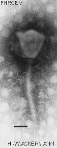 HER443 Image of phage under microscope
